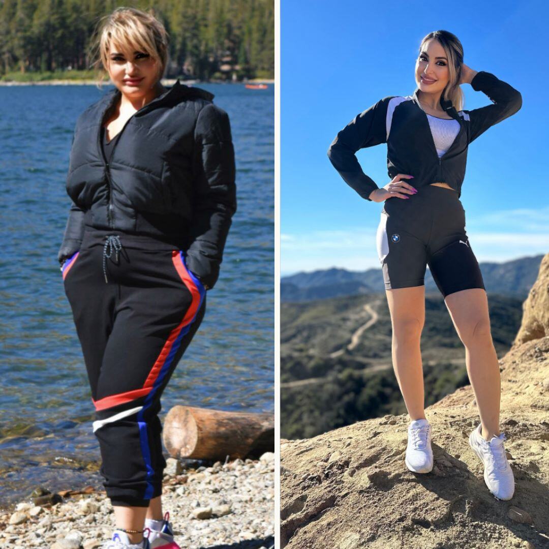 Woman before and after weight loss